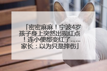 密密麻麻！宁波4岁孩子身上突然出现红点！连小便都变红了……家长：以为只是摔伤